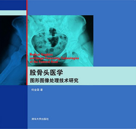 股骨頭醫學圖形圖像處理技術研究