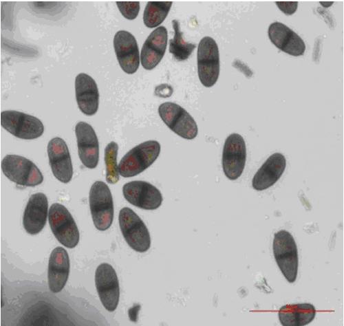 Botryosphaeria rhodina分生孢子