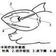 卡耳療法