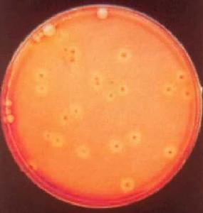 金黃色葡萄球菌A蛋白