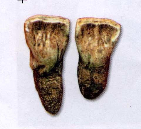 牙齒化石