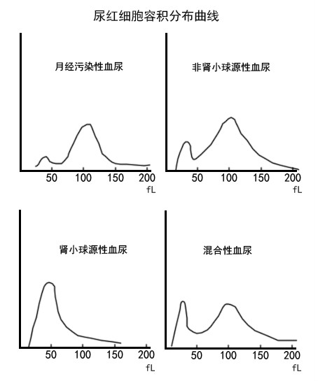 尿紅細胞容積分布曲線