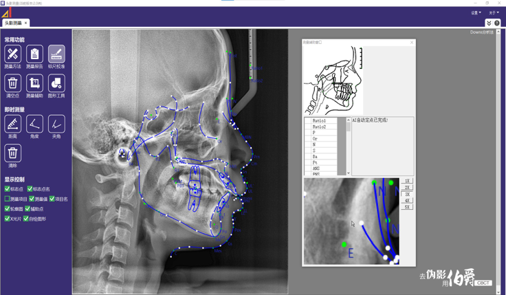 伯爵CBCT