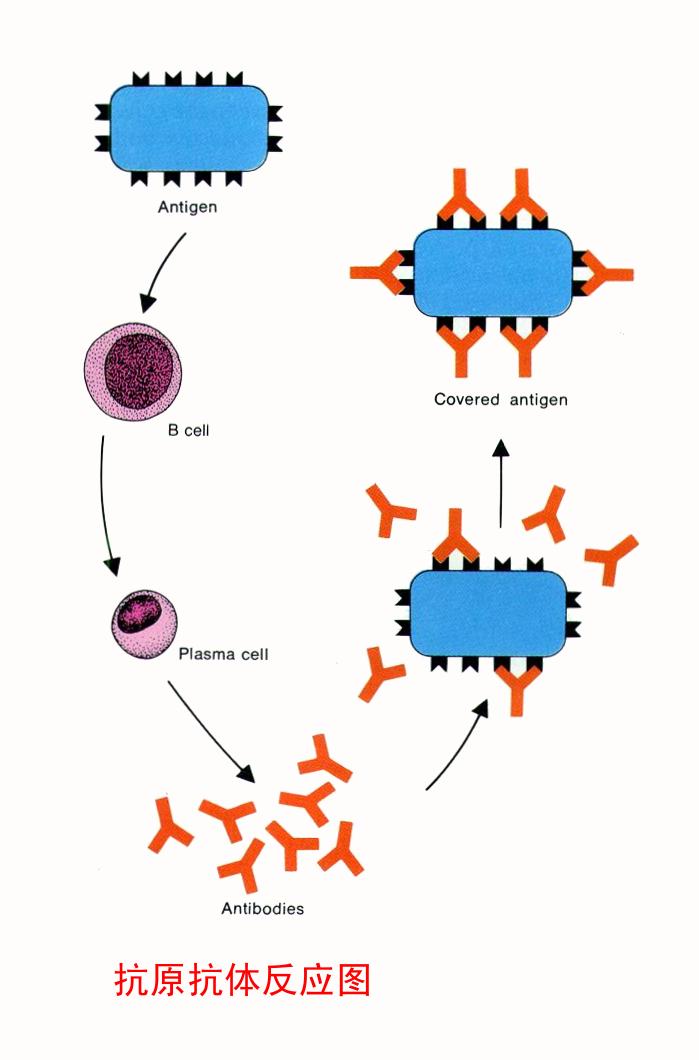 類風濕因子(RF（類風濕性因子（rheumatoidfactor））)