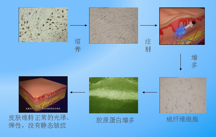 自體細胞肌活治療過程