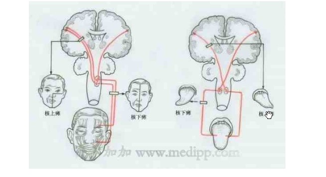 核下癱