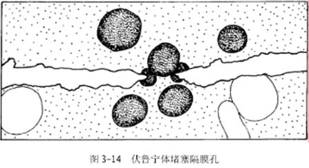 伏魯寧體堵塞隔膜孔