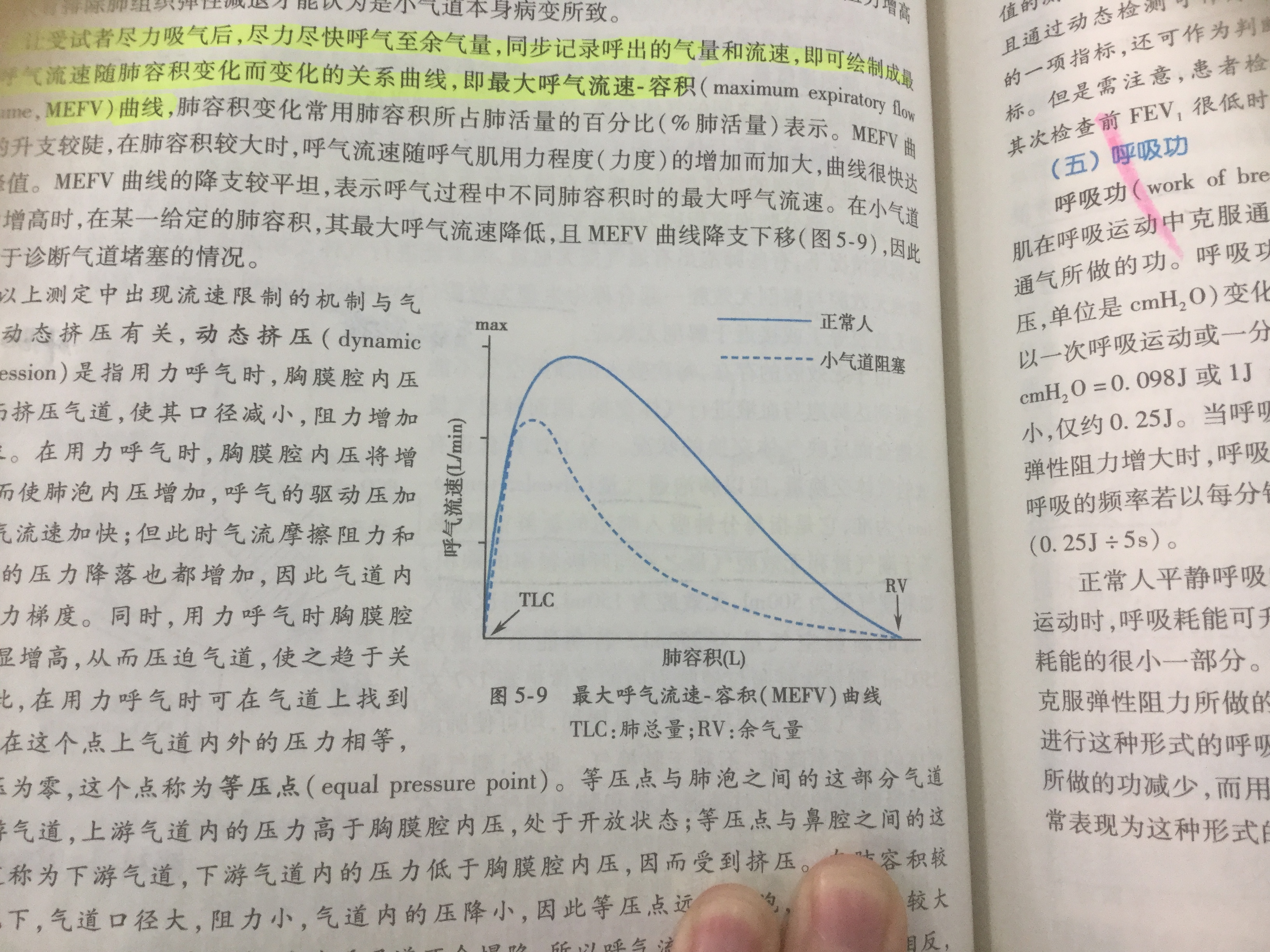 最大呼氣流量容積曲線