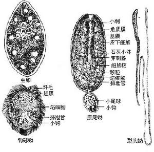 闊節裂頭絛蟲病