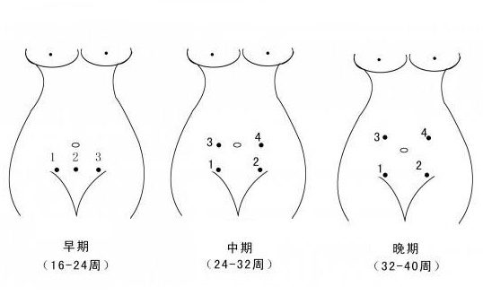 胎音聽診器