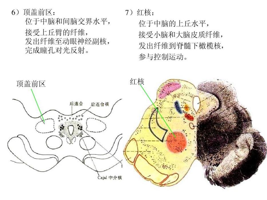 紅核綜合徵