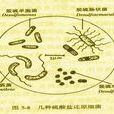 厭氧菌所致肺炎