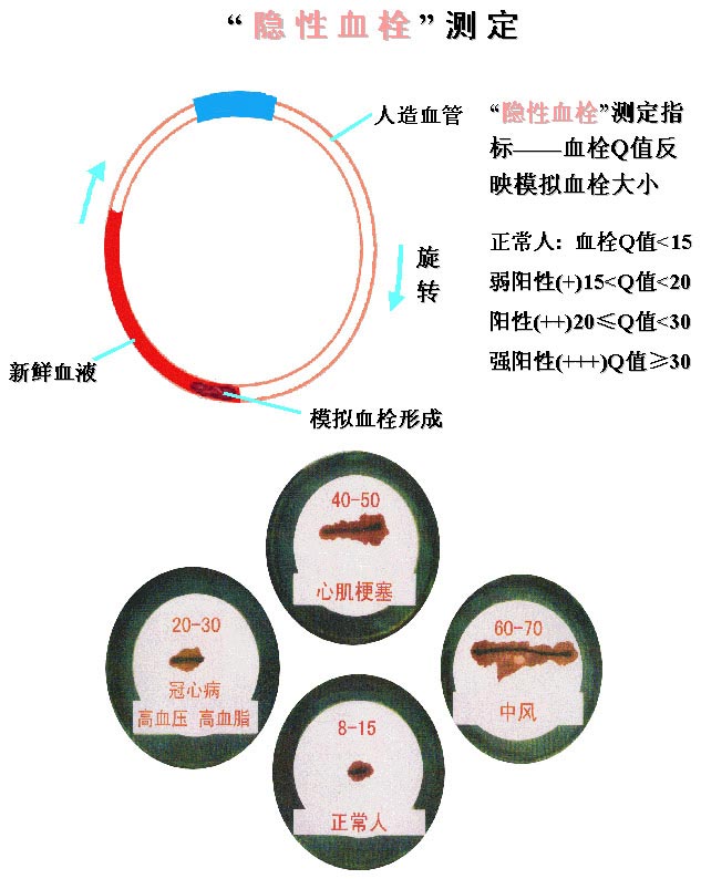 血栓檢測儀——血栓圖譜