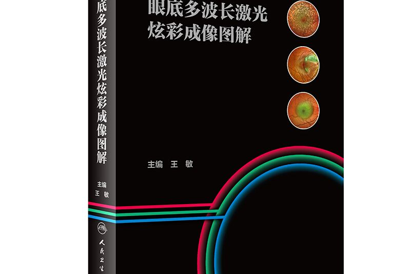 眼底多波長雷射炫彩成像圖解