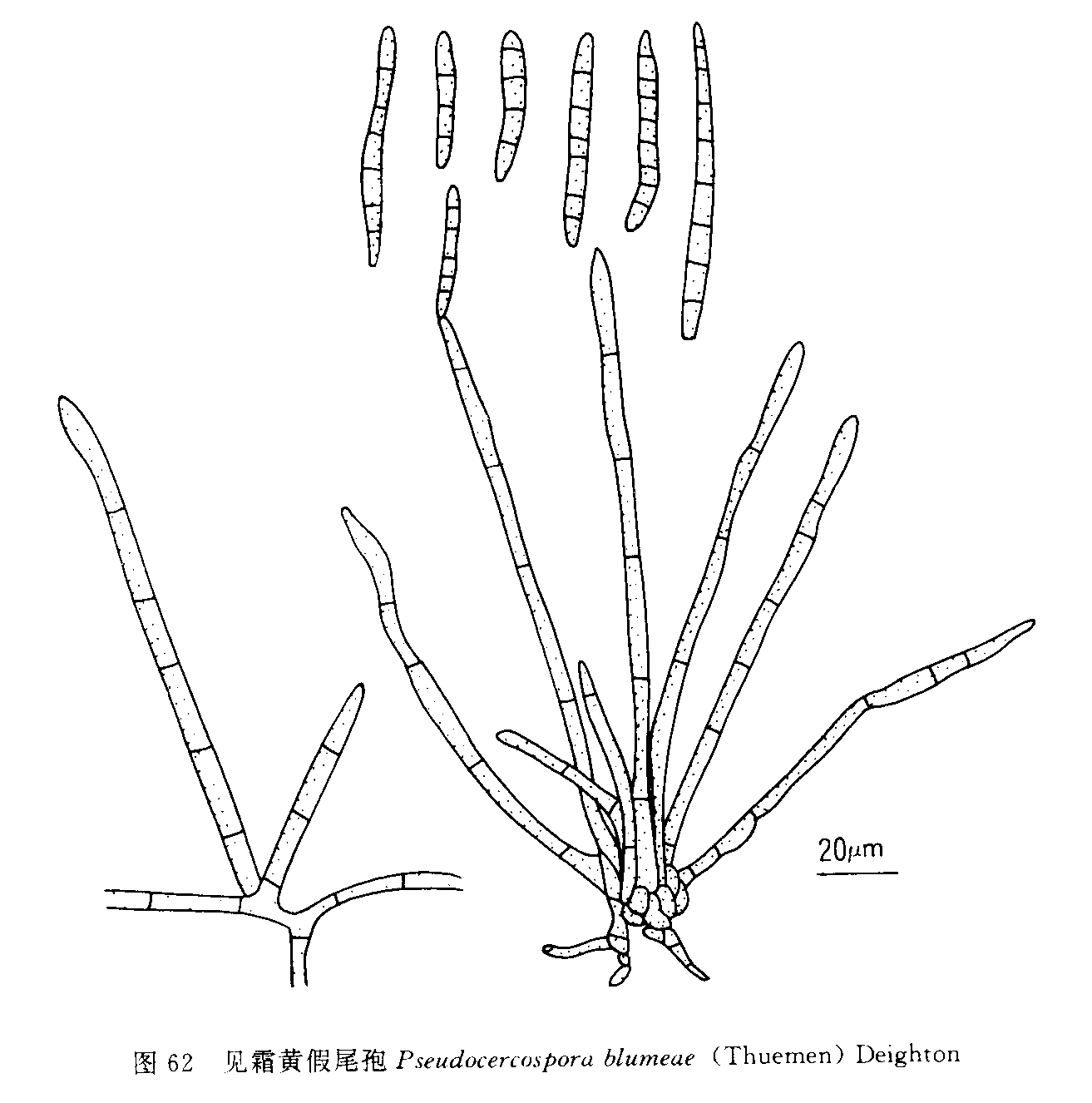 見霜黃假尾孢