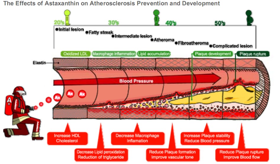 蝦青素抗動脈粥樣硬化機理