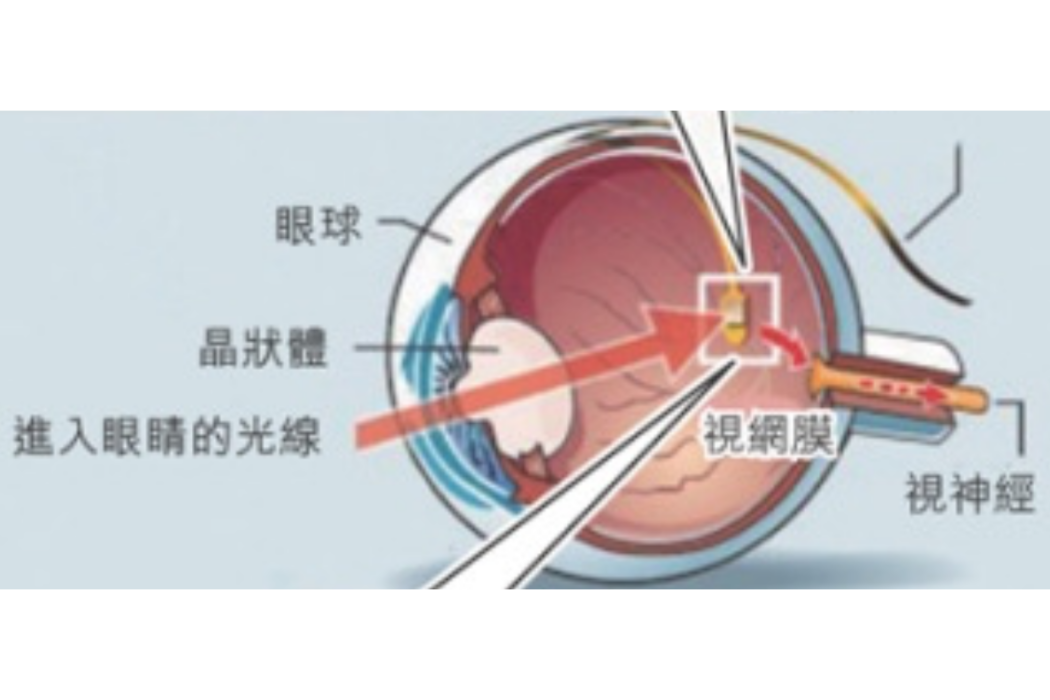 仿生人造眼