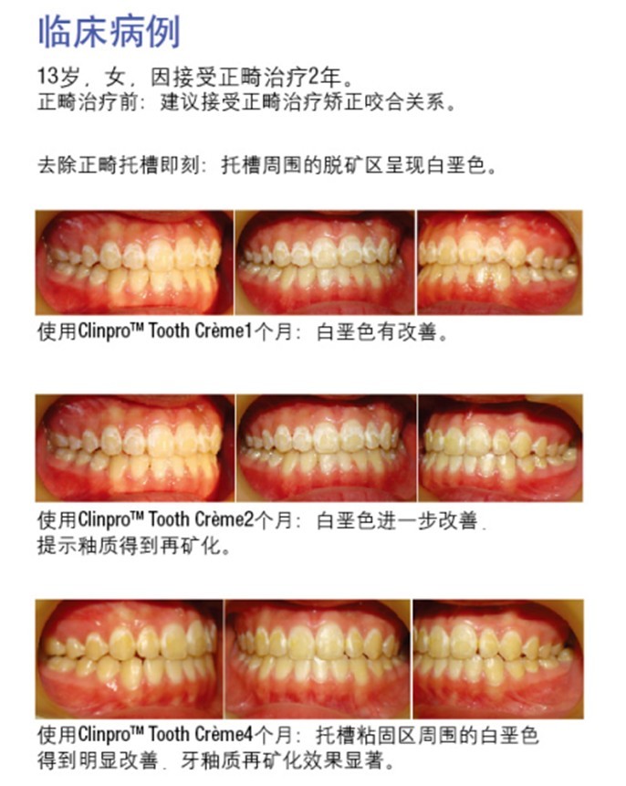 臨床病例