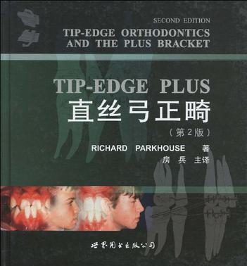 TIP-EDGE PLUS直絲弓正畸