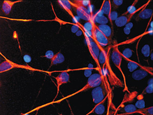 體外培養的神經幹細胞