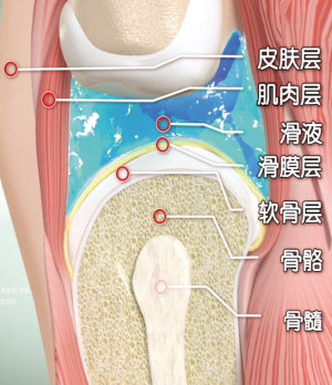 風濕骨痛圖冊