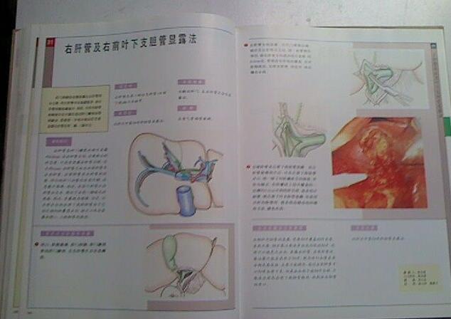 肝膽胰脾手術圖解