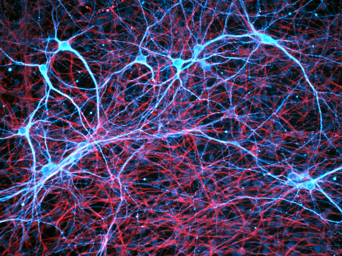 神經膠質細胞