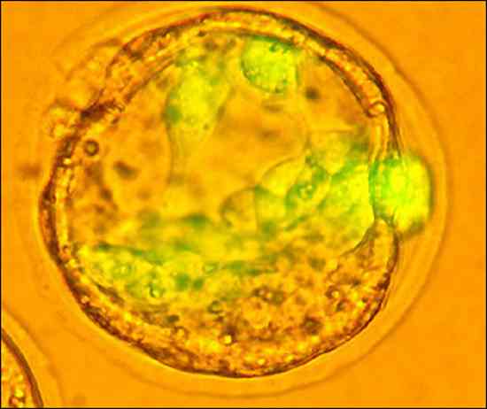 人體胚胎幹細胞
