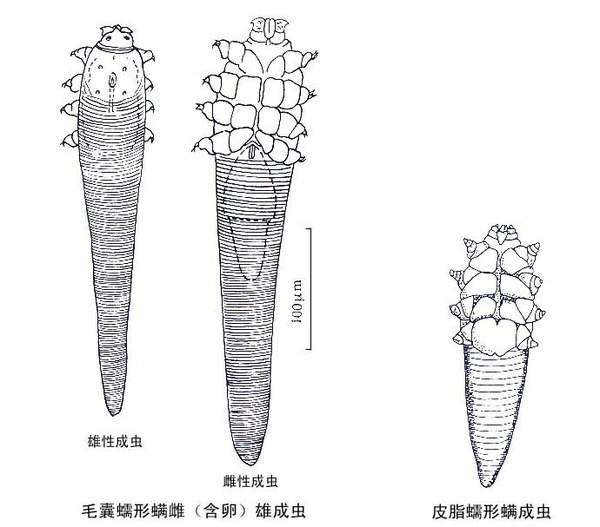 蠕形蟎