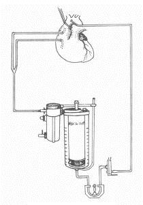 鼓泡式氧合器工作原理示意圖