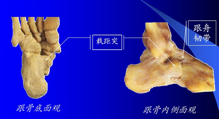 載距突