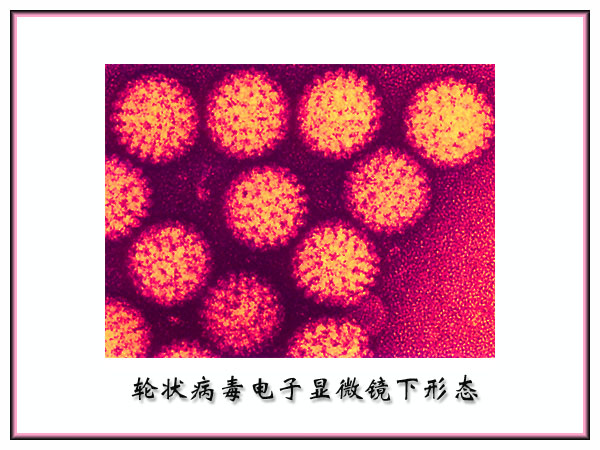 人類輪狀病毒