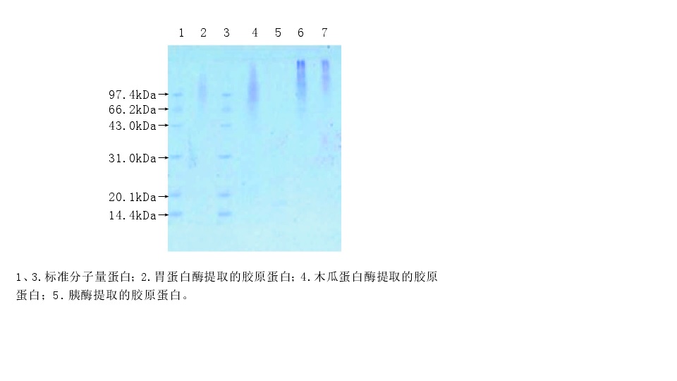 膠原蛋白(膠原質)