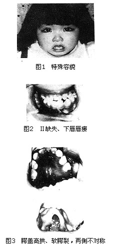 臨床表現