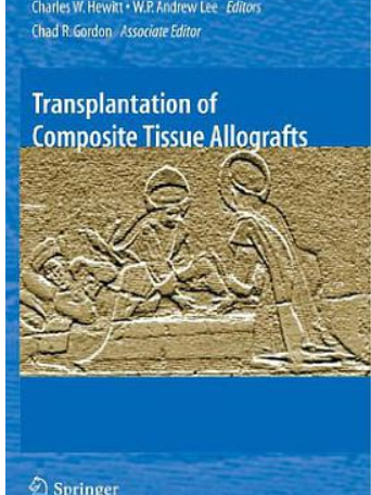 Transplantation of Composite Tissue Allografts