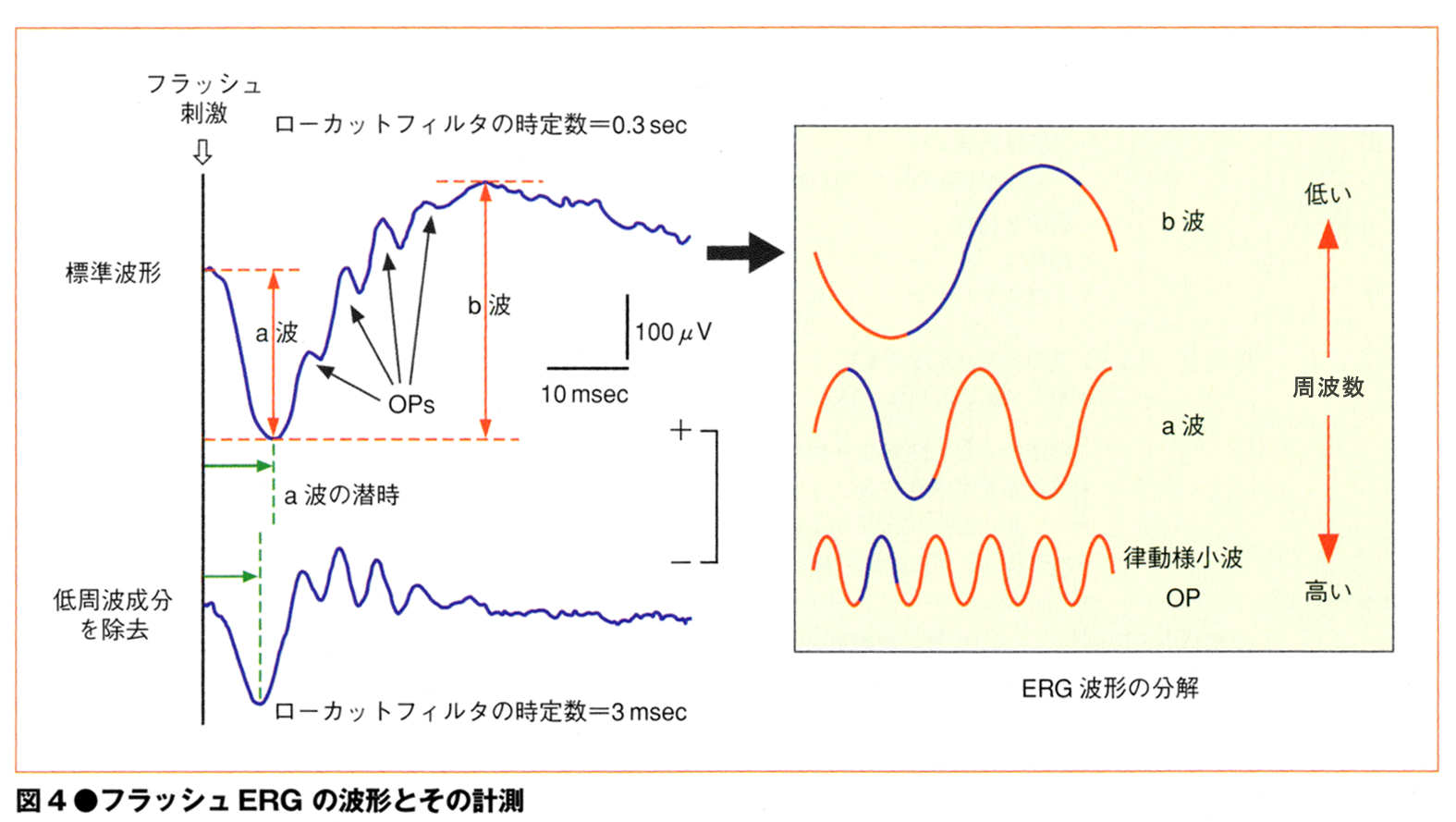 視網膜電圖