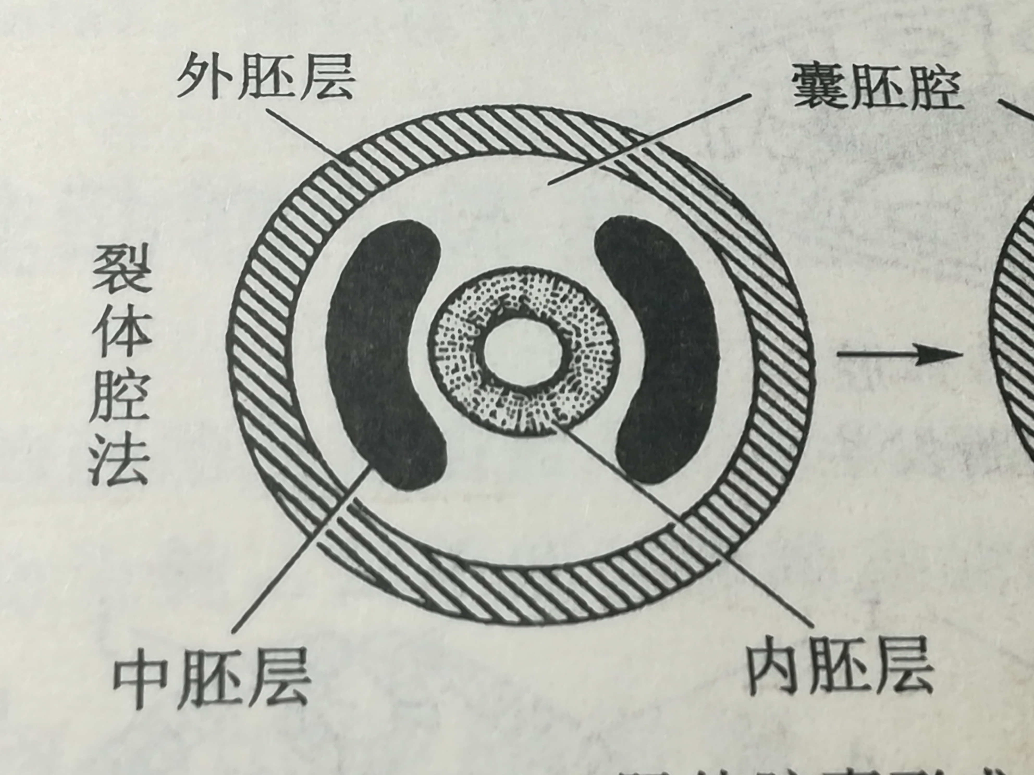 端細胞法