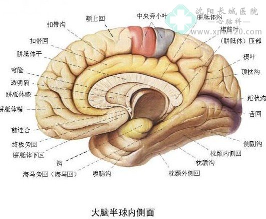 間歇性腦梗塞