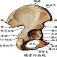 髖外側腫脹壓痛