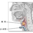 氣管造口術