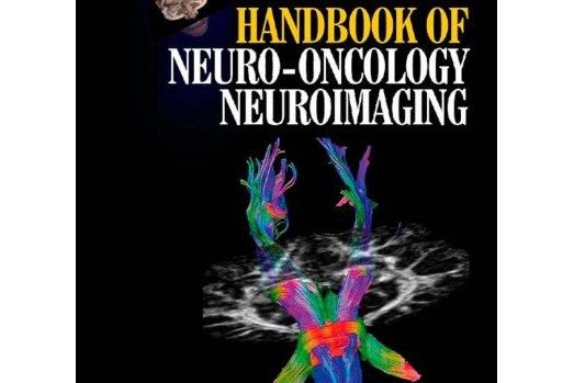 Handbook of Neuro-Oncology Neuroimaging