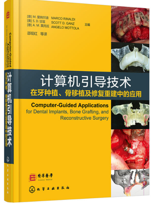 計算機引導技術在牙種植、骨移植及修復重建中的套用