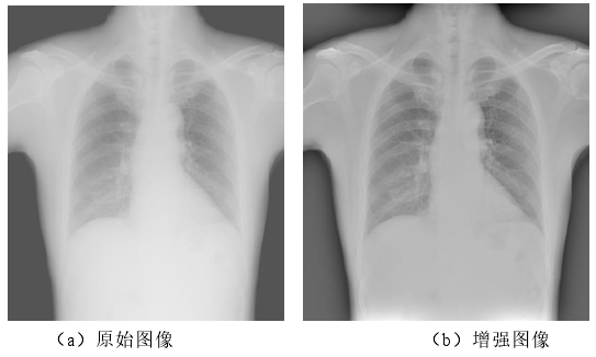 圖象增強