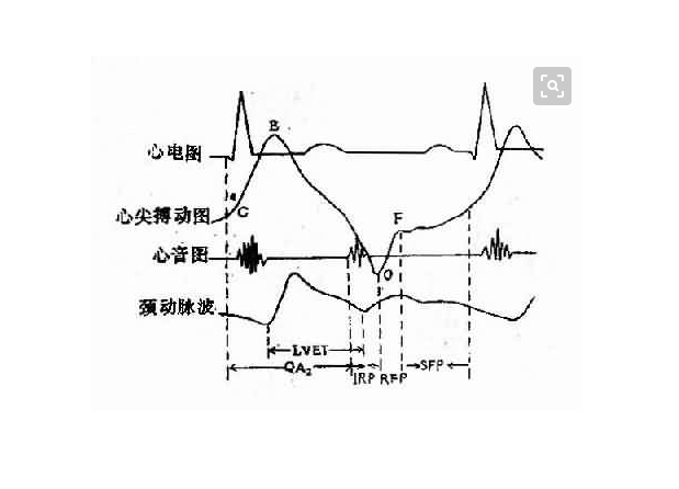 心音圖室