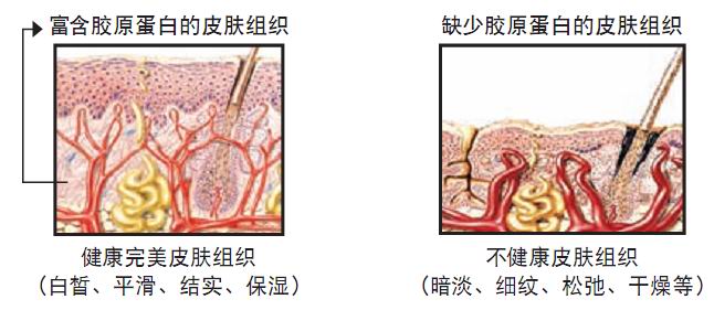 魚尾紋產生機理