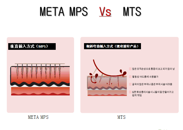 凱琳絲