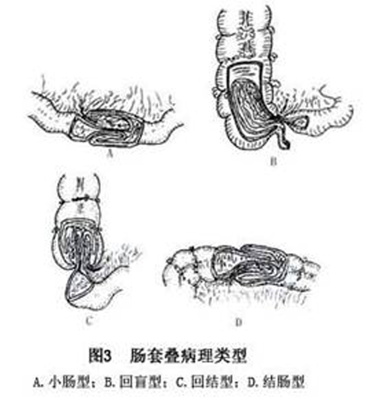 尖頭小吻盲蟲