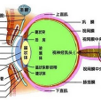 晶狀體抗原性葡萄膜炎