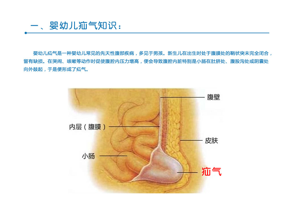 氣肚臍