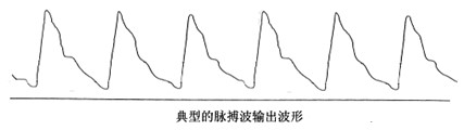 脈搏的典型壓力波形，可以用於病理性分析